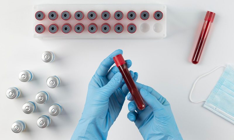 Check-up Anual: Os Principais Exames de Sangue para Monitorar sua Saúde