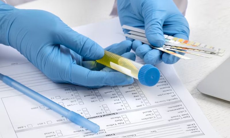 Exame Toxicológico: O Que É, Como É Feito e Quando É Necessário