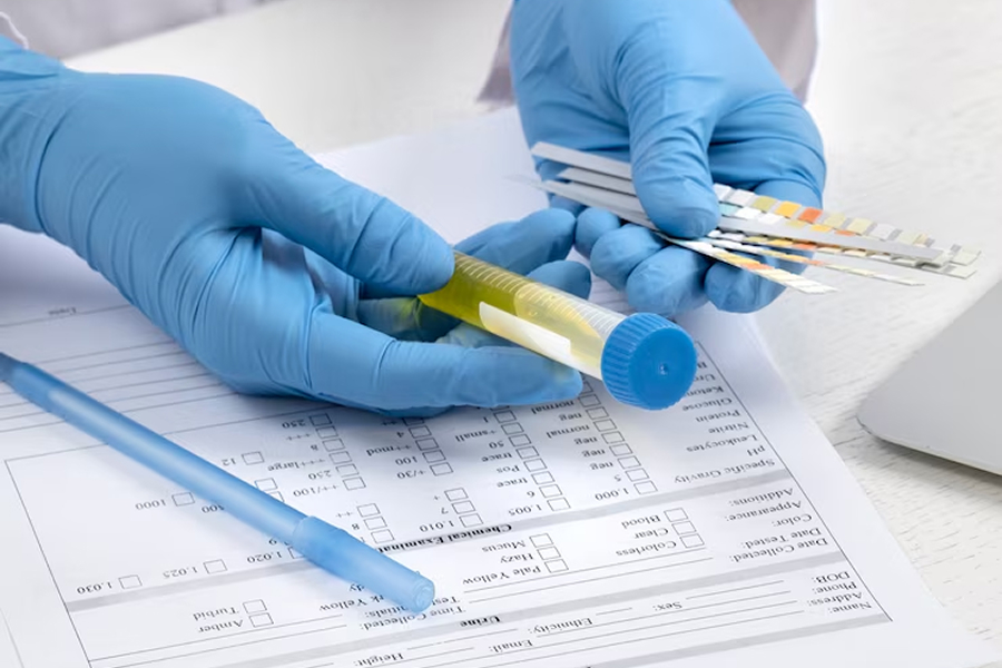 Exame Toxicológico: O Que É, Como É Feito e Quando É Necessário